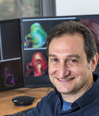 Juan Raul Cebral, professor of bioengineering, focuses on examining the blood flow in brain aneurysms to improve understanding of the causes, enhance aneurysm risk assessment, and evaluate devices and minimally invasive procedures.